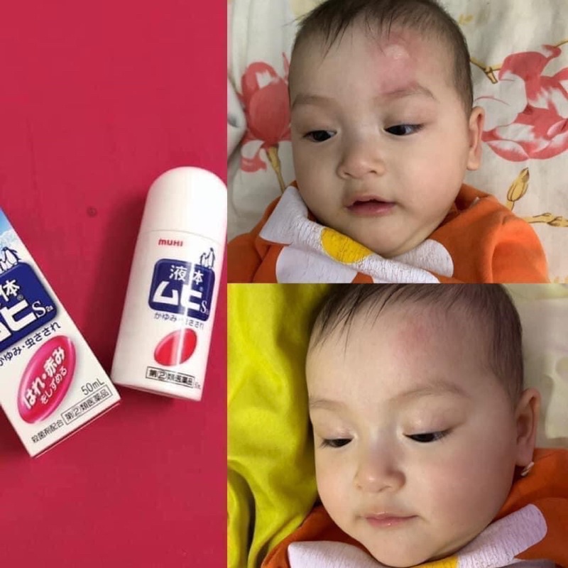 Lăn muỗi Muhi nhật