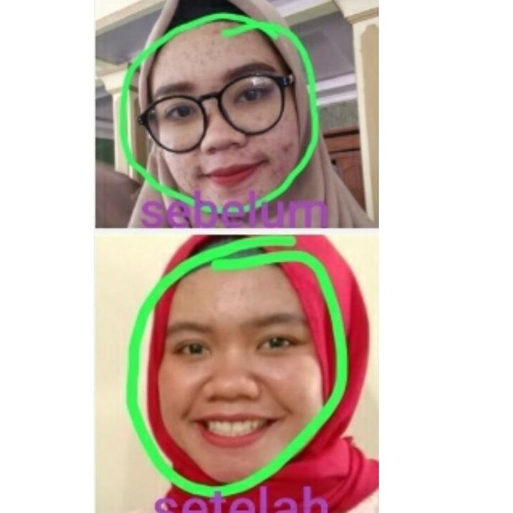 ⭐ Xịt Cố Định Mizuco (Bộ 139) (trims,.) | BigBuy360 - bigbuy360.vn