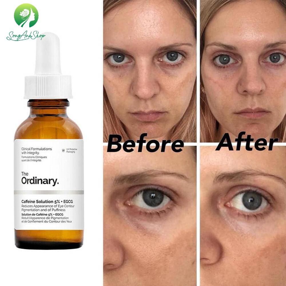 Serum giảm thâm quầng mắt The ordinary caffeine solution 5 + egcg 30ml