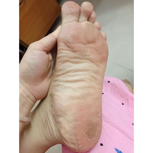 Túi Ủ Tẩy Tế Bào Chết Da Chân Lavender Foot Care Pack To Plan của Nhật Bản