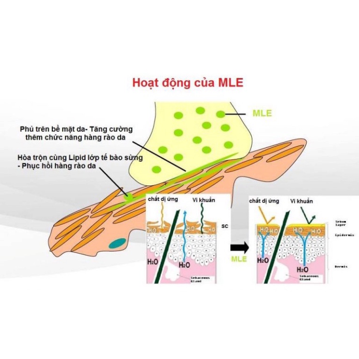 [ Chính Hãng] KEM DƯỠNG MẶT DA KHÔ NẺ CHÀM ATOPALM FACE CREAM TRẺ SƠ SINH,TRẺ EM,NGƯỜI LỚN &lt;35ml&gt;