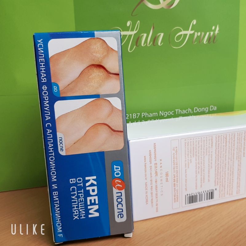 kem dưỡng gót chân Nga kpem chính hãng