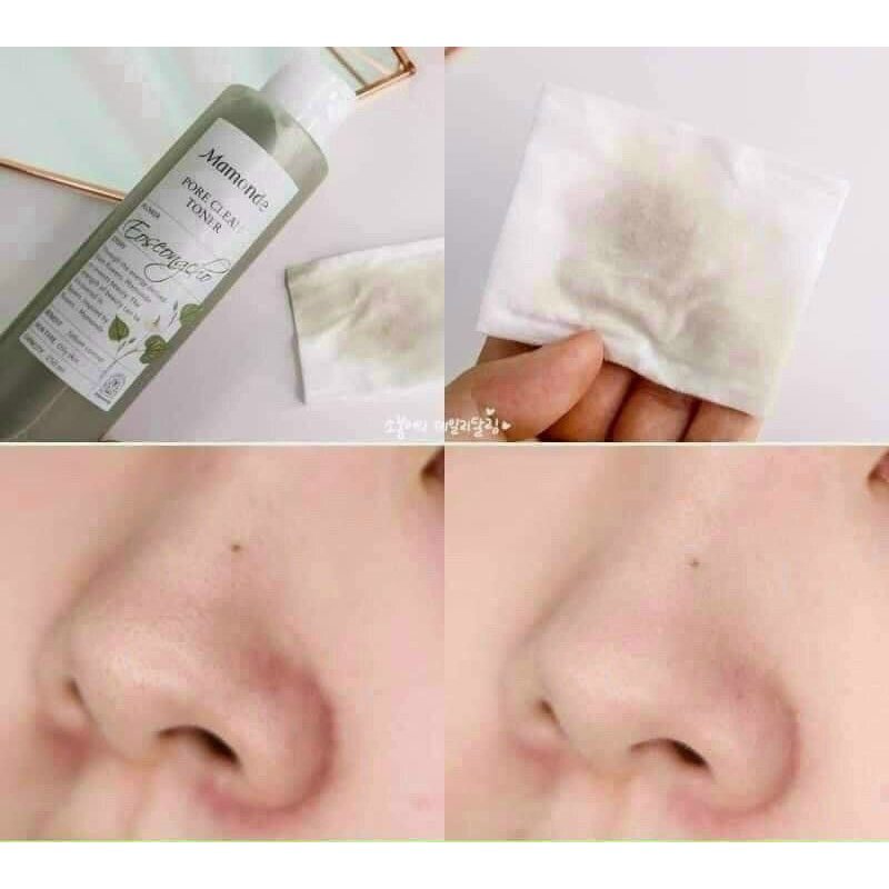 Toner tạo bọt Calming &amp; Hydrating Refresh Toner