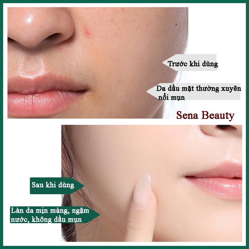 Toner dạng bông thấm làm sạch sâu axit salicylic 2% dành cho da dầu mụn Sena Beauty | BigBuy360 - bigbuy360.vn