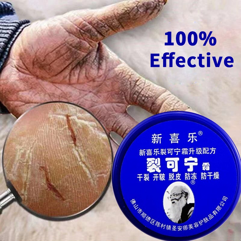 Kem Dưỡng Da Chân/Tay/Chân Chống Nứt Nẻ/Bong Tróc/Bàn Tay/Chân 33G 55g