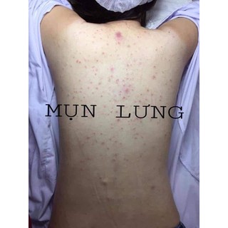 Xà phòng nghệ thái lan