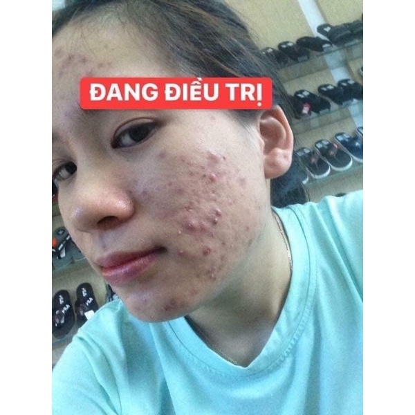 COMBO 2 cốt nhân sâm