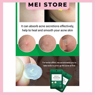 Miếng dán mụn BREYLEE cao cấp