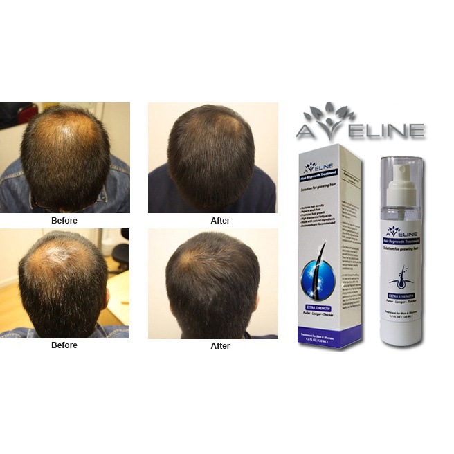 Thuốc mọc tóc Aveline - Mỹ