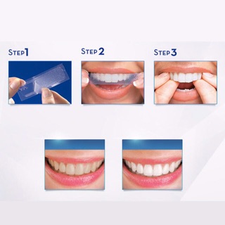 Miếng dán trắng răng 1 miếng