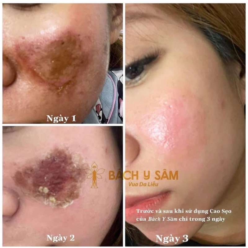 Dưỡng da 123 Bách Y Sâm Nhất Mộc Hương | BigBuy360 - bigbuy360.vn