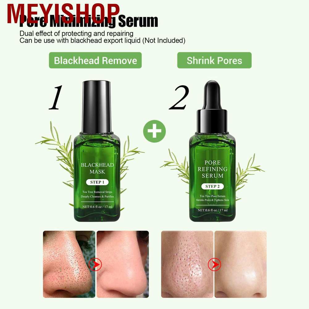 (Hàng Mới Về) Serum Trị Mụn Đầu Đen Làm Sạch Lỗ Chân Lông Chiết Xuất Cây Trà Breylee 17ml