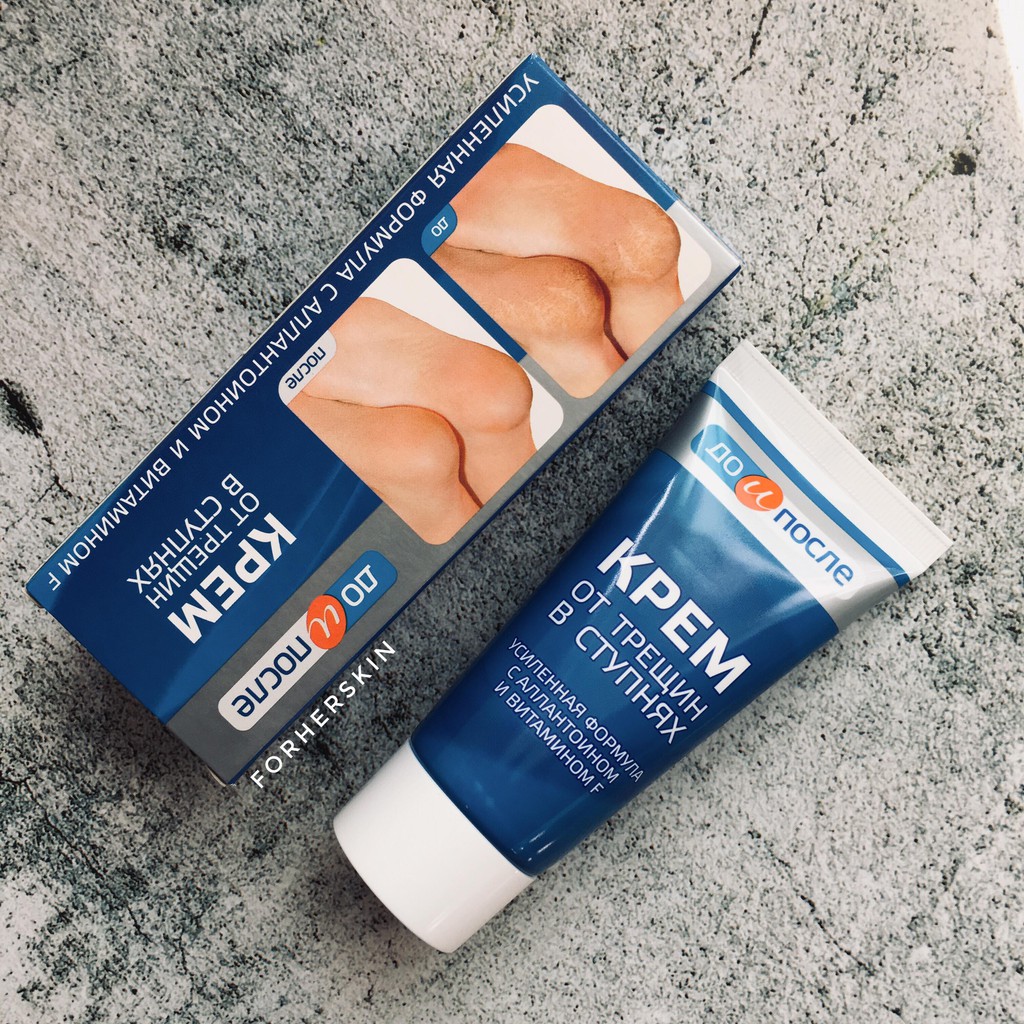 Kem Trị Nứt Gót Chân Kpem (50ml)
