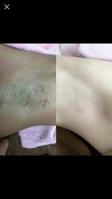 SÁP WAX LÔNG THIÊN NHIÊN SHINNY TẶNG KÈM GIẤY WAX VÀ QUE WAX | BigBuy360 - bigbuy360.vn