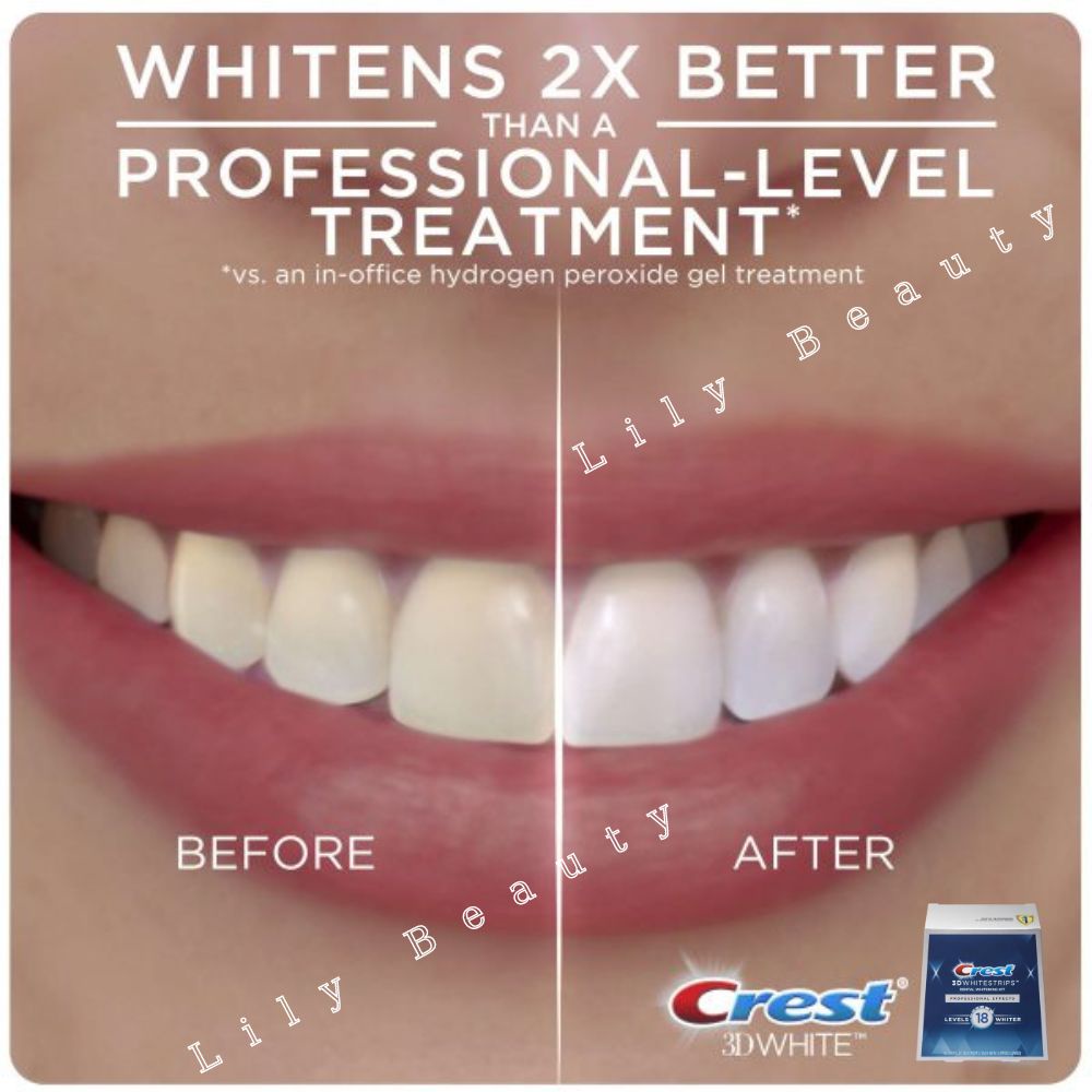 Miếng dán trắng răng Crest Professional Effects Combo 7 gói  – Giúp răng trắng sáng tự nhiên | BigBuy360 - bigbuy360.vn