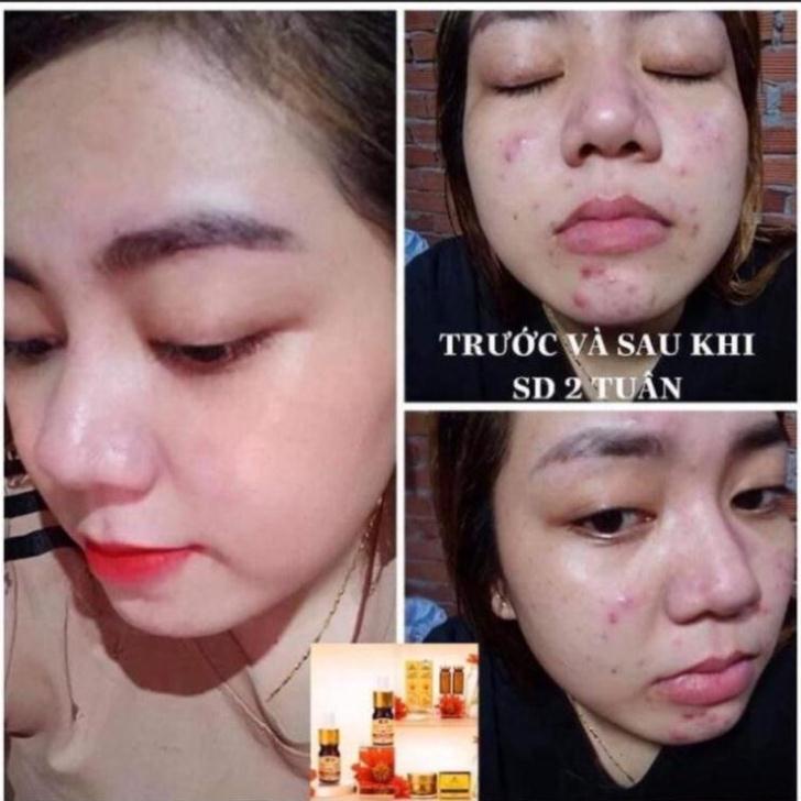 Serum mU  n Collagen X3 Luxury mỹ phẩm Đông Anh Chính Hãng HÀNG CHÍNH HÃNG GIÁ RẺ XẢ KHO