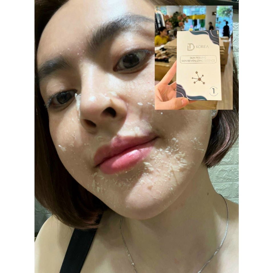 Tinh chất tái tạo da skin peeling Retinol vi tảo Trang Nemo - thay da xoá khuyết điểm sau 1 lần peel da