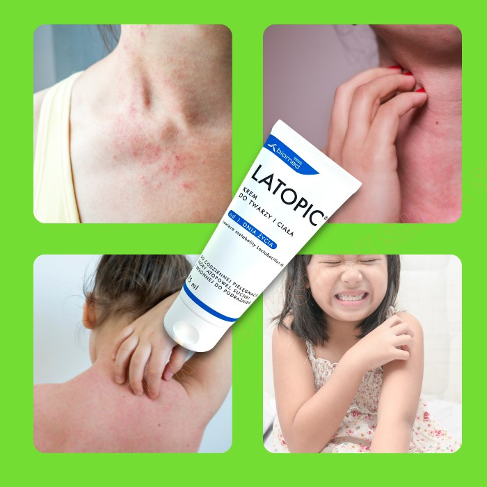 Kem dưỡng da dưỡng ẩm dịu da LATOPIC cho da viêm cơ địa, dị ứng, da khô và da kích ứng, bôi MẶT và TOÀN THÂN | BigBuy360 - bigbuy360.vn