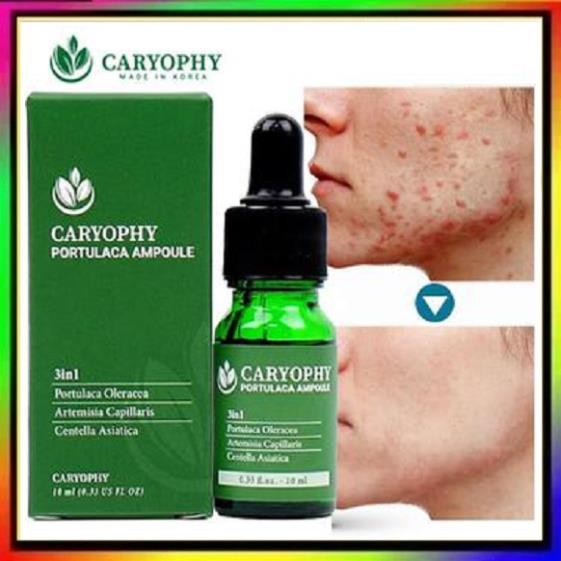 Sỉ-  Serum ngăn ngừa mụn và thâm Caryophy Chính Hãng - Serum Mụn Ngăn Ngừa Mụn Ẩn,Mụn Đầu Đen