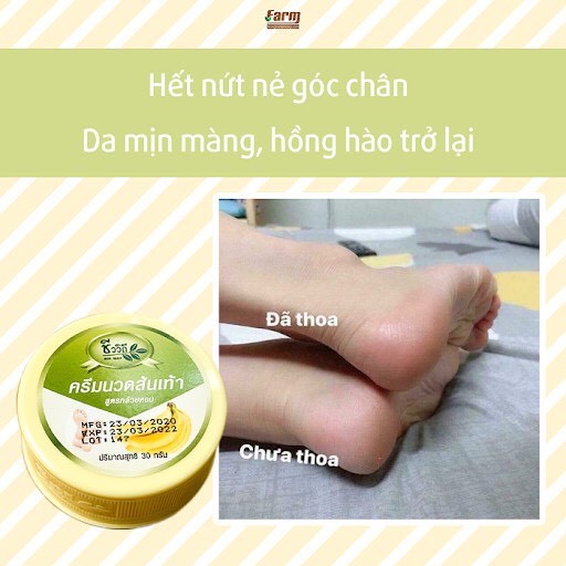 Kem Giảm Nứt Gót Chân BANANA HEEL CREAM 30g Thái Lan