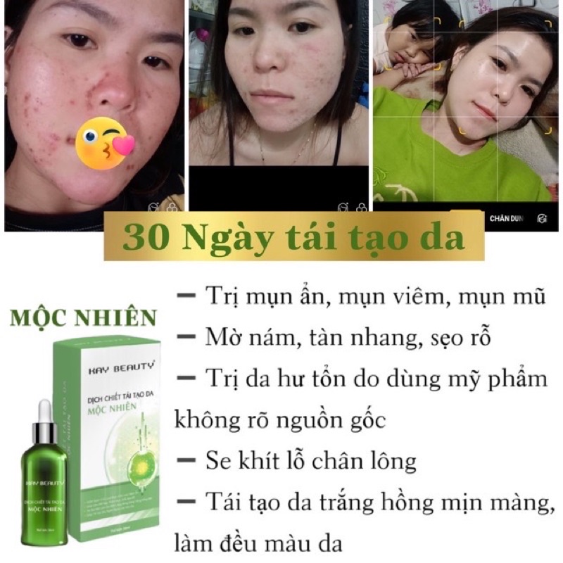 tái tạo da mộc nhiên đông y