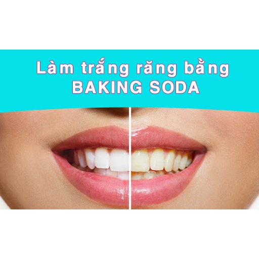 Banking Soda Nt Hương Bạc Hà Chuẩn