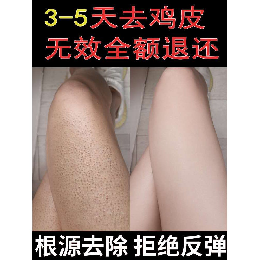 Kem tẩy tế bào chết đào niacinamide làm trắng da toàn thân 200g tiện lợi | BigBuy360 - bigbuy360.vn