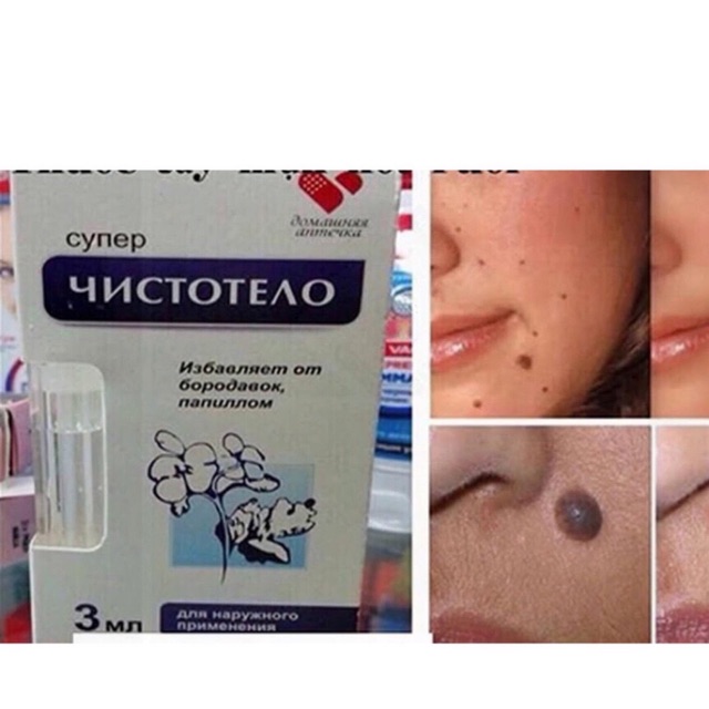 Gel tẩy nốt ruồi klirvin