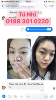 Nước Thần Dưỡng Da - Essence Lifting