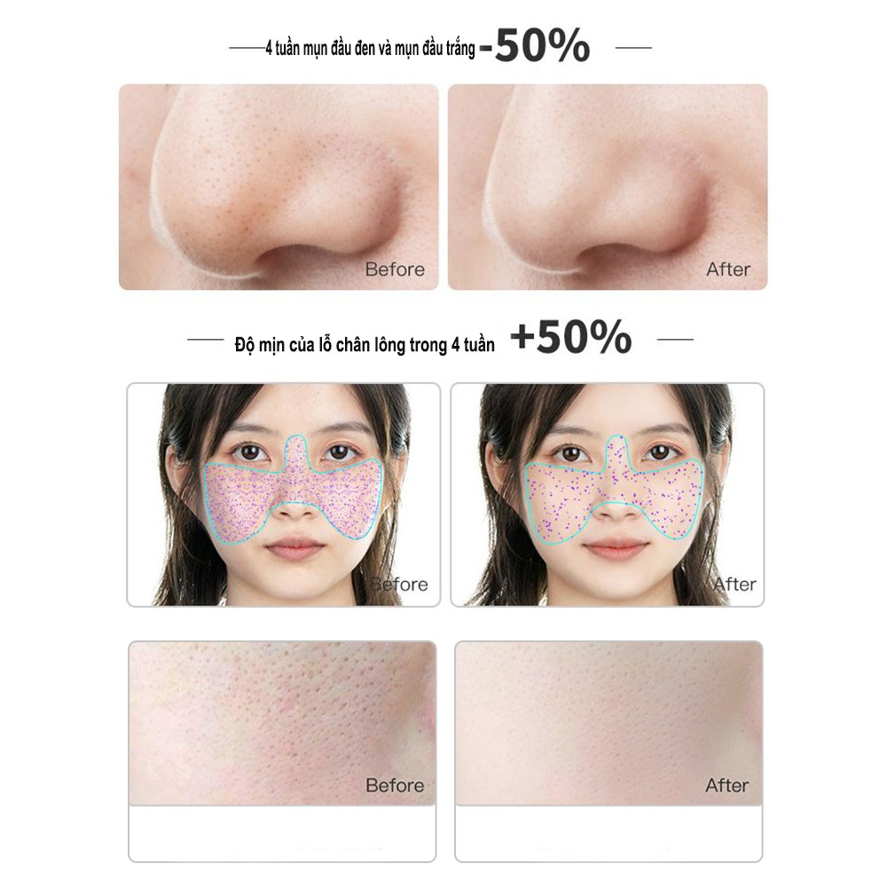 Mặt Nạ Bùn Eiio Làm Trắng Da Làm Sạch Da Lột Mụn Đầu Đen Cho Nữ 100g/ml