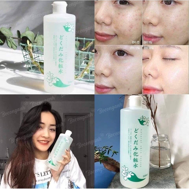 Toner diếp cá + Tía tô