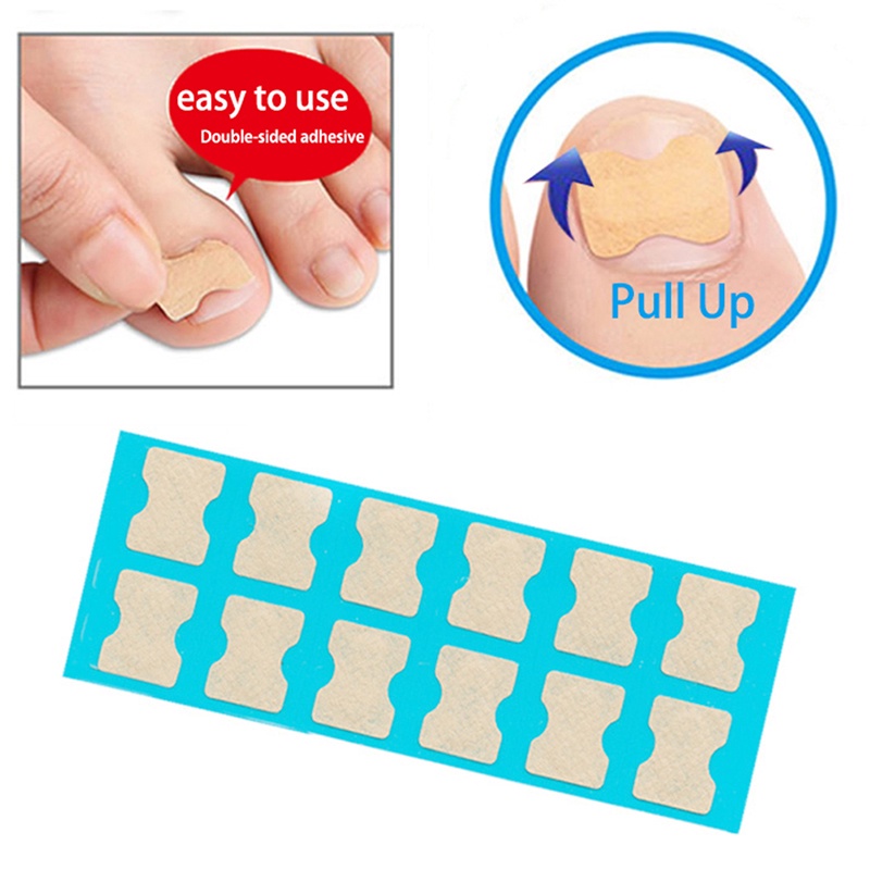 Set 36 / 48 / 60 Miếng Dán Chăm Sóc Bàn Chân