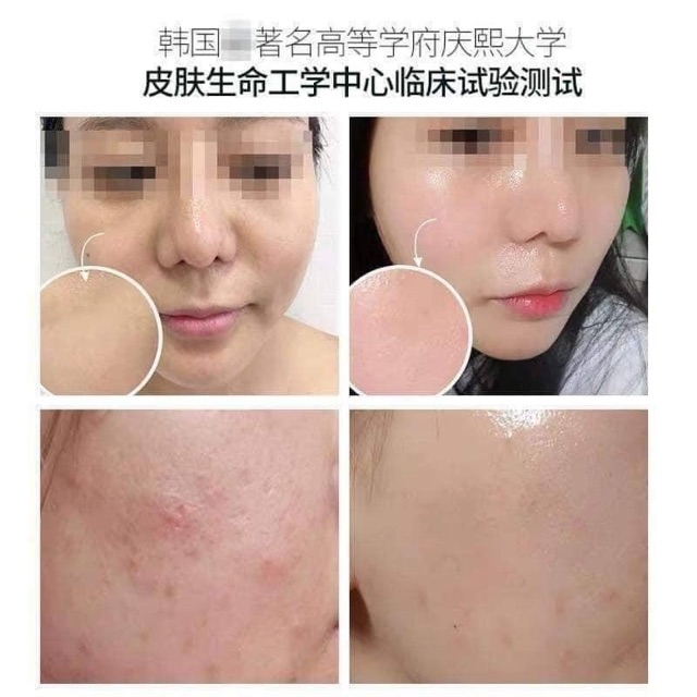 Set Dưỡng Phục Hồi Tái Tạo Da Rejuran | BigBuy360 - bigbuy360.vn