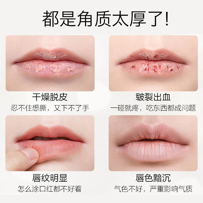 (hàng Mới Về) Gel Tẩy Tế Bào Chết Cho Môi Xiaoyuwan | BigBuy360 - bigbuy360.vn