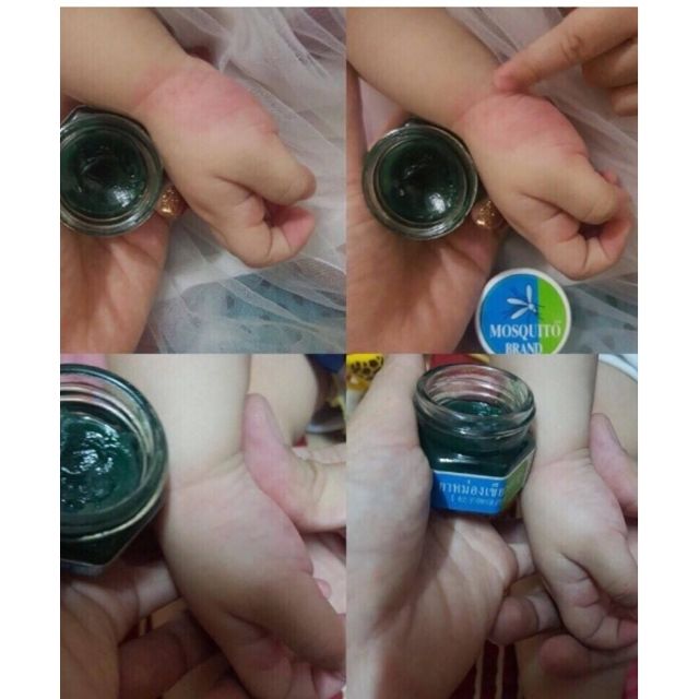 SÁP TRỊ MUỖI ĐỐT GREEN BALM MOSQUITO BRAND