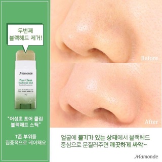 THANH LĂN MỤN ĐẦU ĐEN MAMONDE