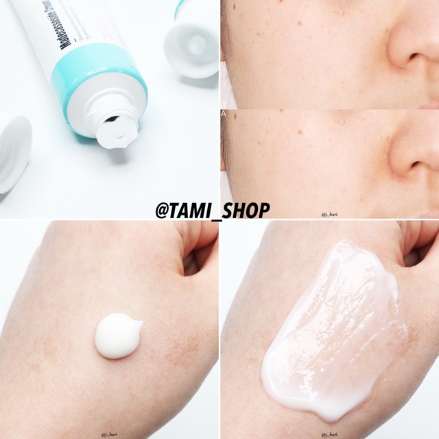 KEM DƯỠNG GIẢM MỤN A’PIEU MADECASSOSIDE CREAM ( TÁCH SET KO CÓ VỎ HỘP ) | BigBuy360 - bigbuy360.vn