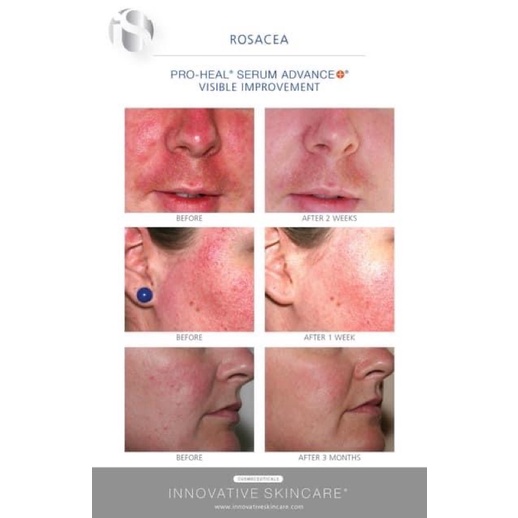 Serum Pro Heal IS CLINICAL