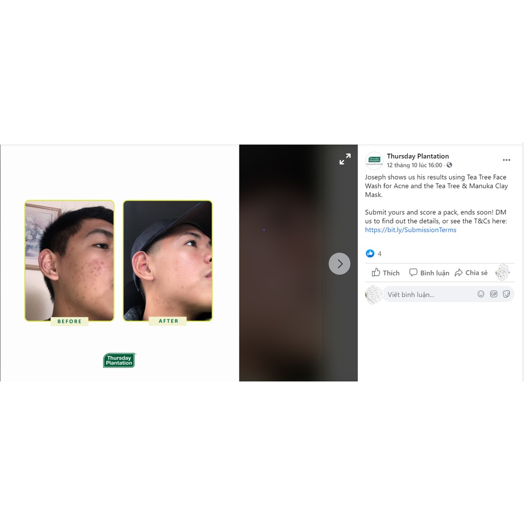 Sữa rửa mặt ngừa mụn Thursday Plantation Tea Tree Acne Face Wash 150ml