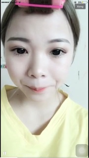 [ FREE SHIP ] Tinh chất tạo mắt 2 mí Pháp