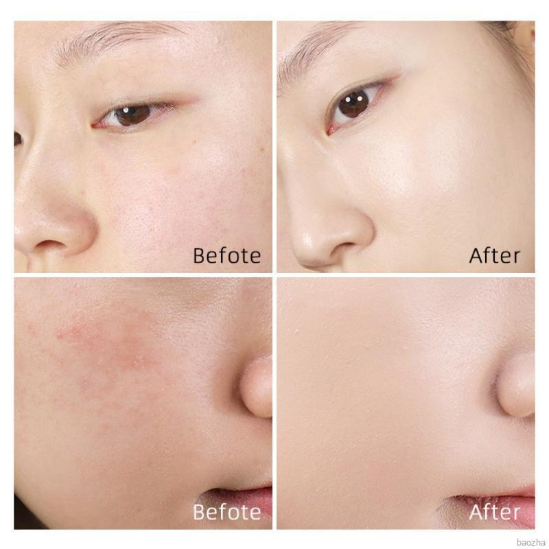 (Hàng Mới Về) Bảng Kem Che Khuyết Điểm Tinh Chất Ốc Sên Dưỡng Ẩm Che Phủ Tàn Nhang Lỗ Chân Lông Làm Đều Màu Da | BigBuy360 - bigbuy360.vn
