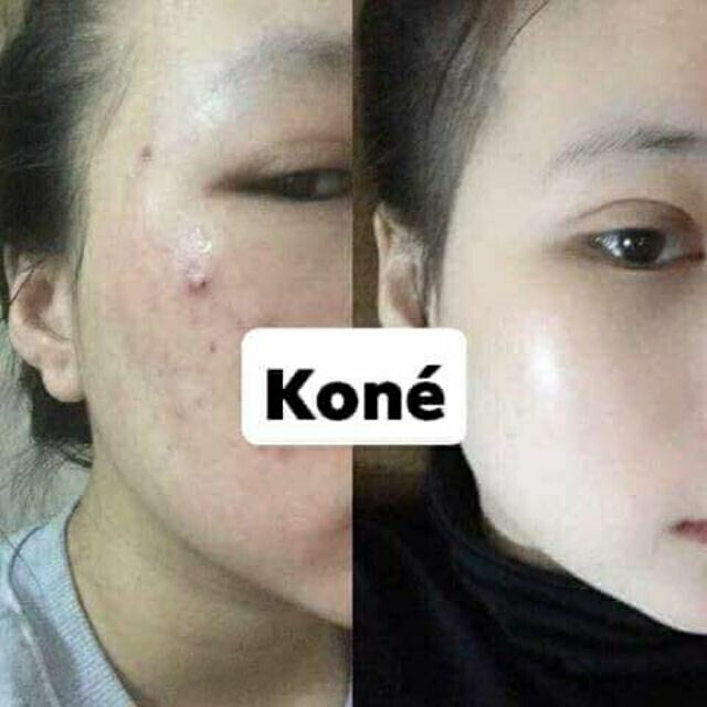 [Hot Trend]  Face Đêm Kem  Koné Dưỡng Ban Đêm