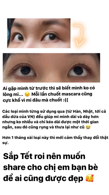 Serum dưỡng mi NUTRALUXE LASH MD (Mỹ)