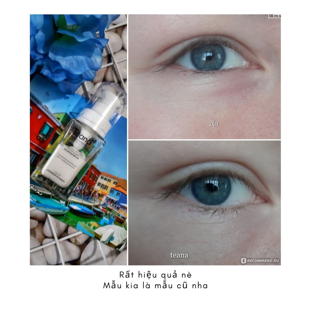  Kem dưỡng mắt Teana Blue Retinol chống lão hóa, mờ nhăn, bọng mắt, thâm quầng | BigBuy360 - bigbuy360.vn