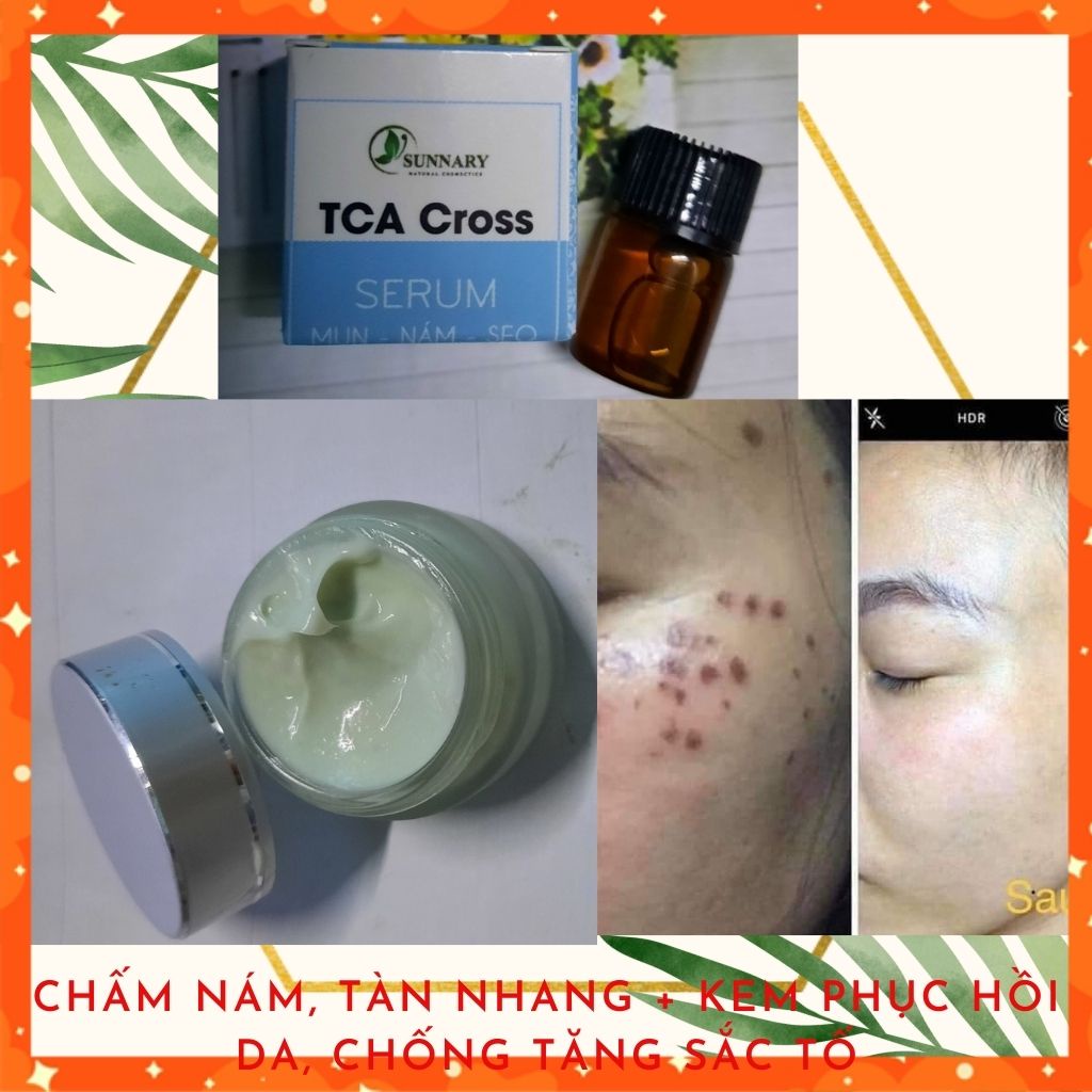 Combo Chấm nám, tàn nhang + Kem phục hồi da, chống tăng sắc tố Loại bỏ các hắc tố đen nám, tàn nhang căng bóng Handmade