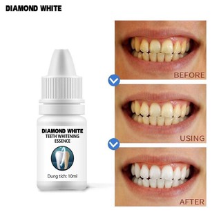 thuốc tẩy trắng răng tại nhà