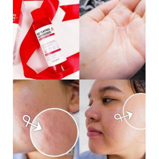Nước hoa hồng Some By Mi Red Tea Tree Cicassoside Final Solution