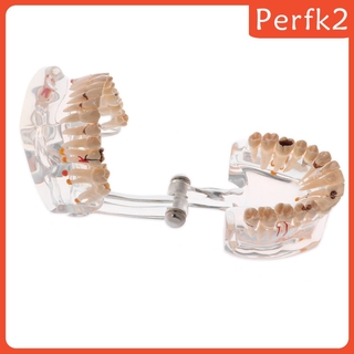 2x Human Mouth Dental Teeth Pathological Model Teaching Study Tools Clear