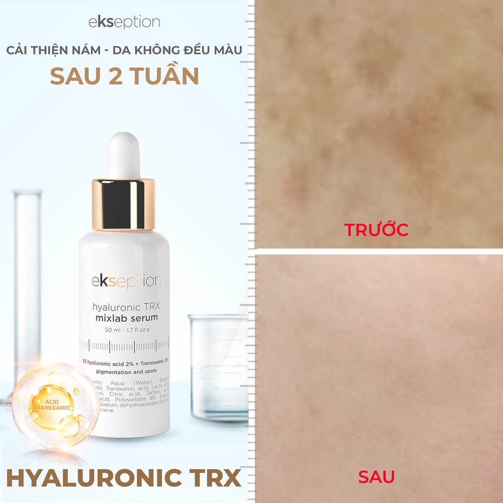 Tinh Chất Sáng Da, Mờ Nám EKSEPTION Hyaluronic TRX 50ml
