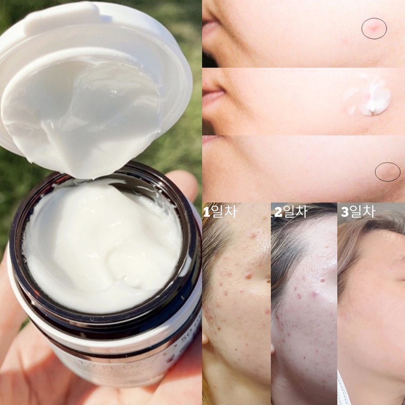 Kem dưỡng Niacinamide Bielenda Dr. Medica Antiacne Dermatological giảm mụn, mờ thâm 50ml